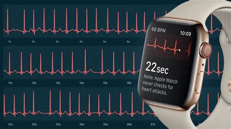 How Accurate the ECG Is on Your Apple Watch | Qaly