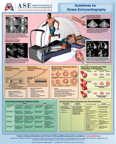 ASE Poster 5: Guidelines for Stress Echocardiography | Medical ...