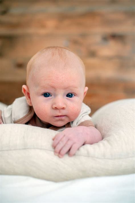 Allergies, Atopic Dermatitis on the Face Stock Image - Image of baby ...