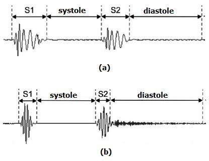 Phonocardiogram Microphone Clipart