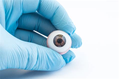 Prosthetic Eye (Ocular Prosthesis): Types, Costs, and Care