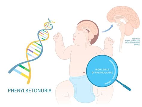 Phenylketonuria- Symptoms, Causes, Treatments, & More