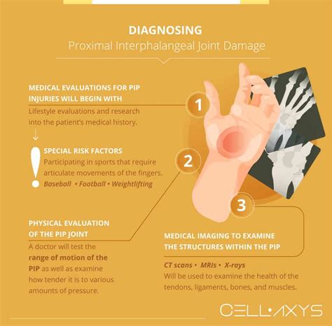 What To Do About Proximal Interphalangeal (PIP) Joint Pain? - Cellaxys