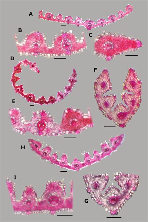 Leaf blade anatomy in transversal section of Agrostis species, in ...