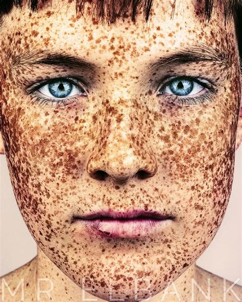 Stunning Portraits Celebrate the Unique Beauty of Freckled Faces