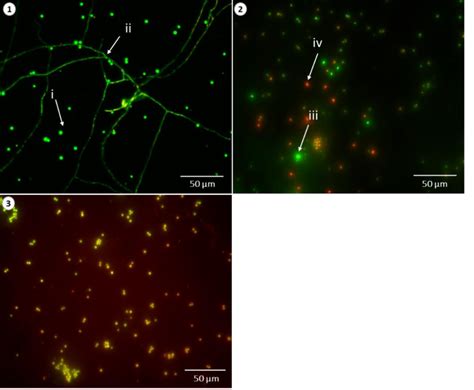 Fluorescent microscopic images of fungal spores, stained with two ...