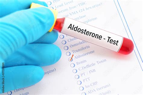 Blood sample with requisition form for aldosterone hormone test Stock ...