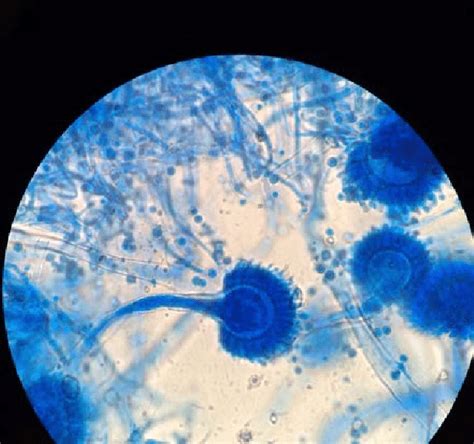 Aspergillus Flavus Under Microscope