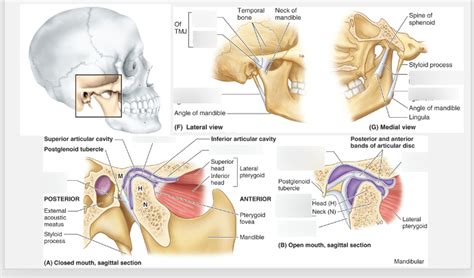 Temporomandibular (TMJ) Joint Labeling Diagram | Quizlet