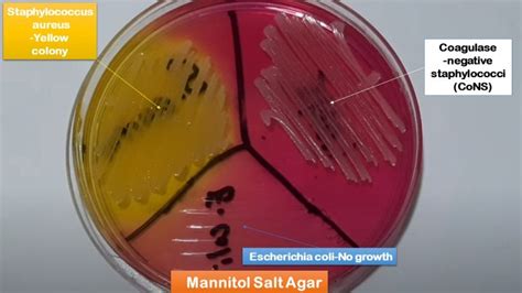 Mannitol Salt Agar: Introduction, Composition, Preparation, Colony Charact