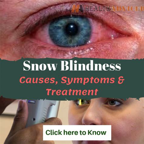 Snow Blindness: Causes, Picture, Symptoms and Treatment