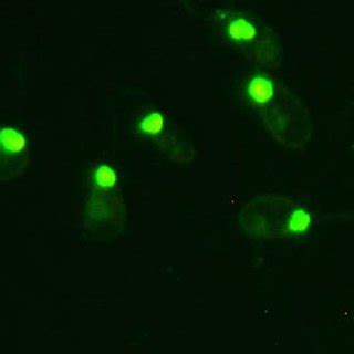 (PDF) The classification of Crithidia luciliae immunofluorescence test ...