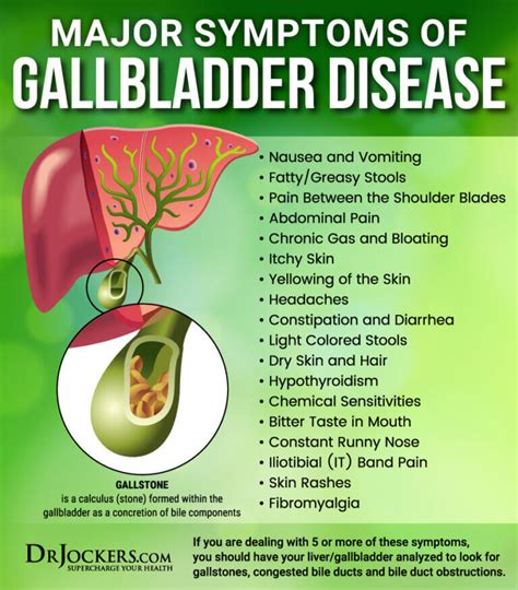 22 Symptoms of GallBladder Disease - DrJockers.com