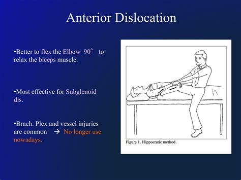 PPT - Shoulder Dislocation PowerPoint Presentation, free download - ID ...