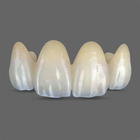 BruxZir Solid Zirconia Crowns - Good Sam Dental