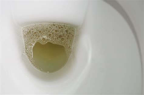 Foamy Urine: Is it a Symptom of a Kidney Disease? | BlackDoctor.org