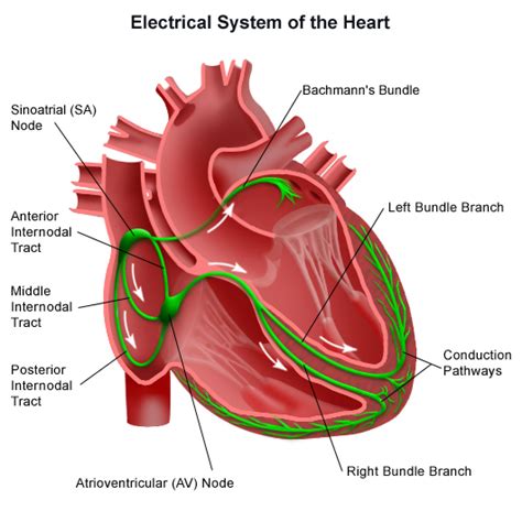 Arrhythmias in Children