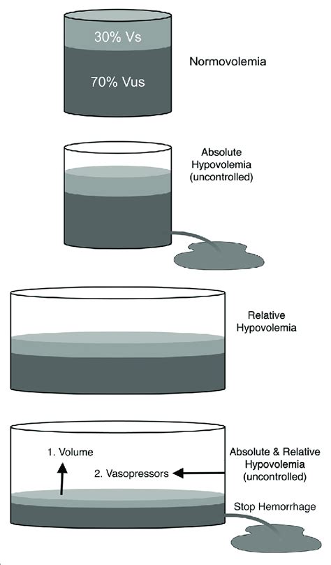 | Schematic representation of total blood volume within the ...