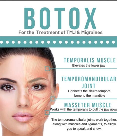 Botox for TMD pain - Robinson Dentistry