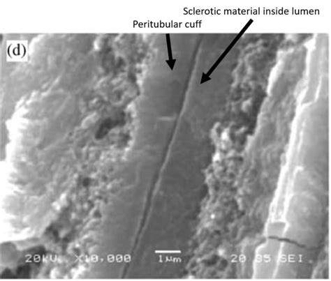 Fractured surface of sclerotic dentin [103] | Download Scientific Diagram