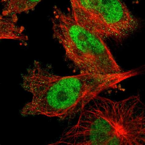 DNA Ligase III Antibody (PA5-52333)