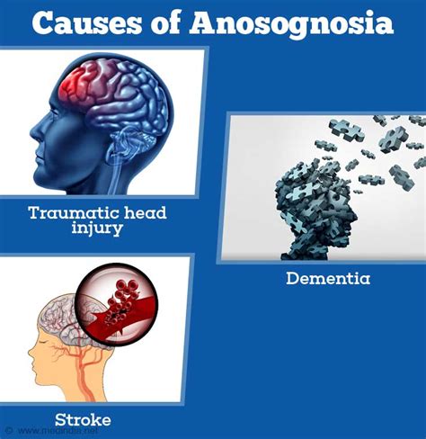 Anosognosia - Causes, Symptoms, Diagnosis, and Treatment