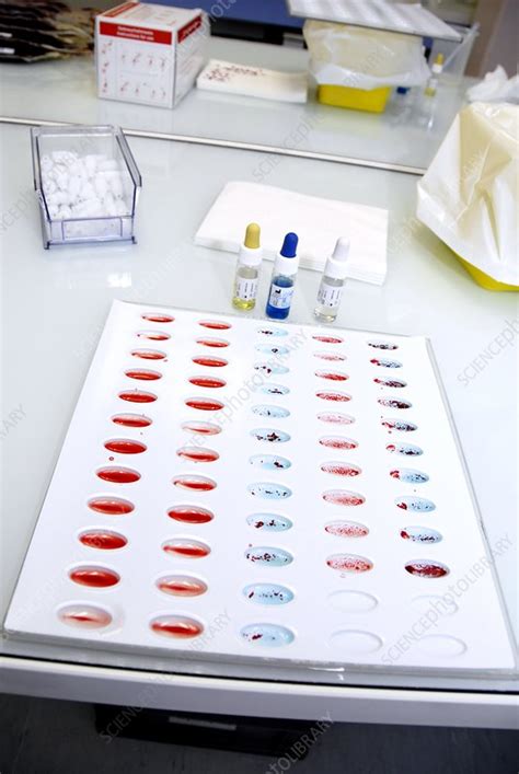 Blood group test - Stock Image - C001/3317 - Science Photo Library