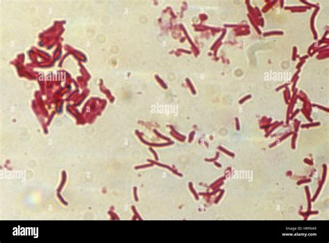 Clostridium perfringens bacteria hi-res stock photography and images - Alamy