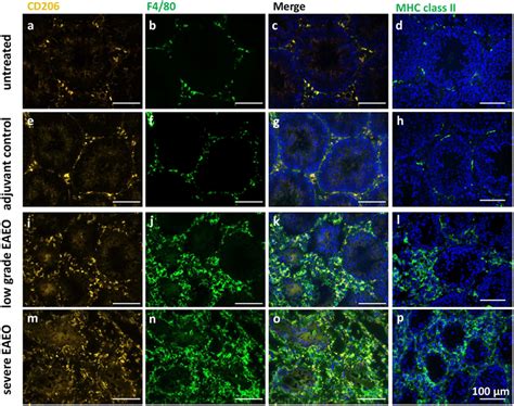 Double staining for CD206 (AlexaFluor546, orange) (a,e,i,m) and the ...