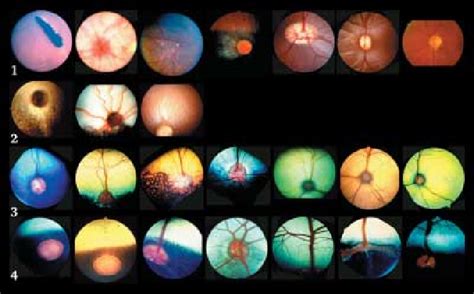 Tapetum Lucidum Diagram