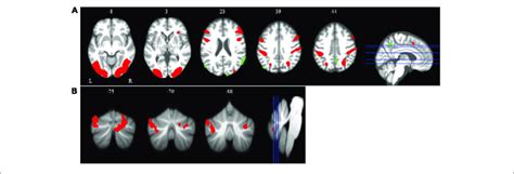 | Main effect of spatial working memory. The spatial working memory... | Download Scientific Diagram