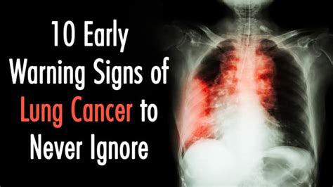 10 Early Warning Signs of Lung Cancer to Never Ignore