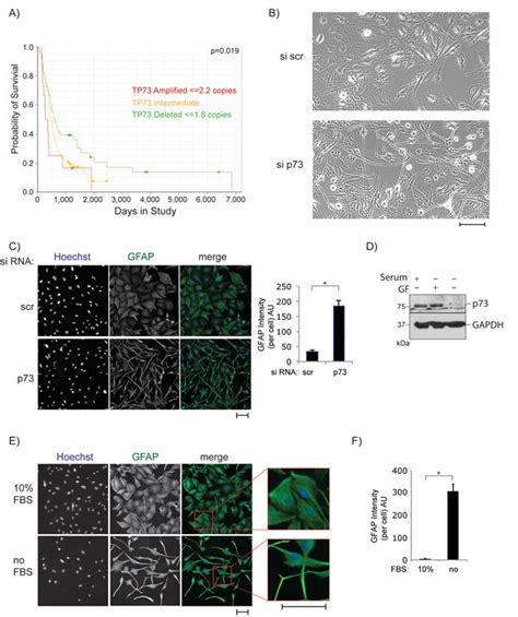 p73 promotes glioblastoma cell invasion by directly activating POSTN (periostin) expression ...