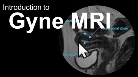 Normal Female Pelvic Mri