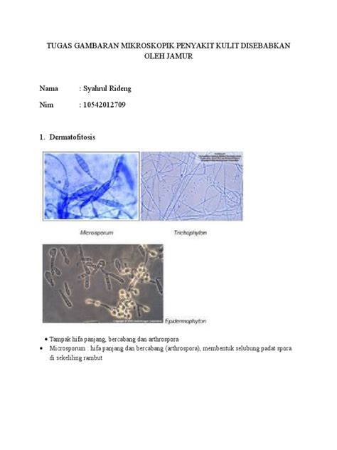 Tugas Gambaran Mikroskopik Penyakit Kulit Disebabkan Oleh Jamur | PDF