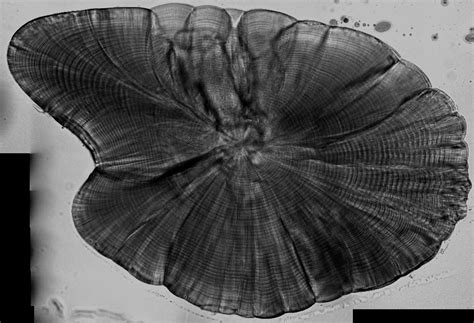 Otolith Microstructure Analysis | Hatfield Marine Science Center ...