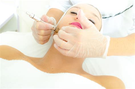 What Is Microdermabrasion? Benefits, Types, and Costs