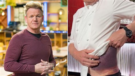 Gordon Ramsay 'lucky' to be alive following serious bicycle accident | Fox News