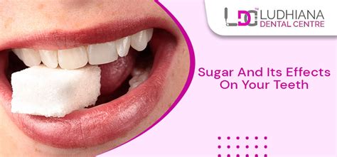 Learn How Does The Sugar Substance Impact Your Dental Health