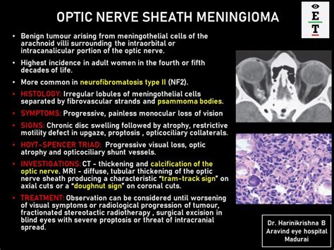 Optic Nerve Sheath Meningioma - EyeToday