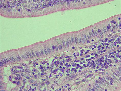 simple columnar epi with goblet cells_intestine_630x, p000139 | OER Commons