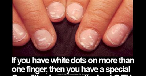 What Causes White Spots On Fingernails