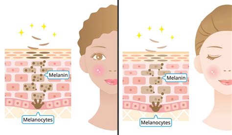 What Is Melanin? How Does Melanin Affect Skin Color?