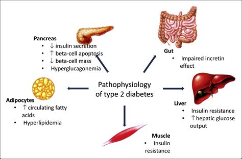 The Early Treatment of Type 2 Diabetes - The American Journal of Medicine