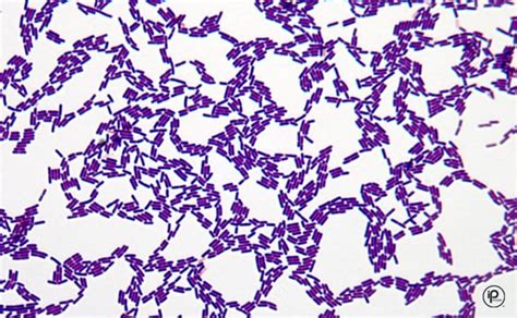 Lactobacillus Gram Stain