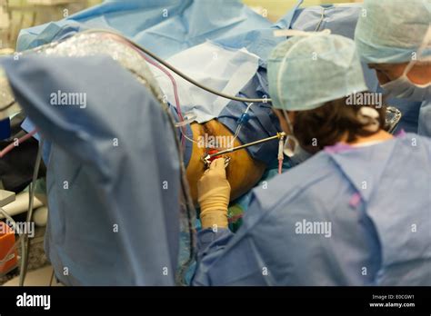 Krankenhausoperation, zum des myoms zu entfernen -Fotos und ...