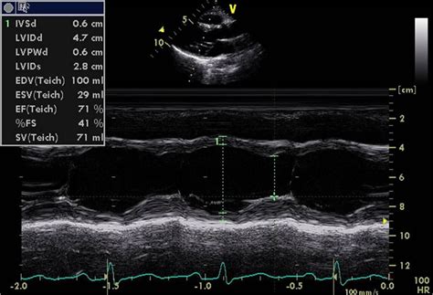 Transthoracic Echo | Sonography student, Echo, Ultrasound