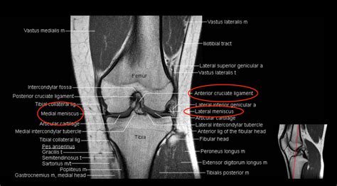 Knee Joint MRI Anatomy