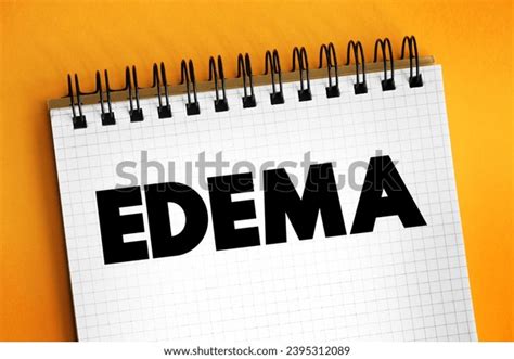 Edema Swelling Caused By Excess Fluid Stock Photo 2395312089 | Shutterstock