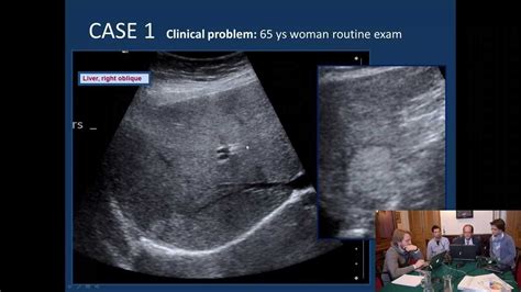 Webinar: Radiology: Sonography of the abdomen II - YouTube